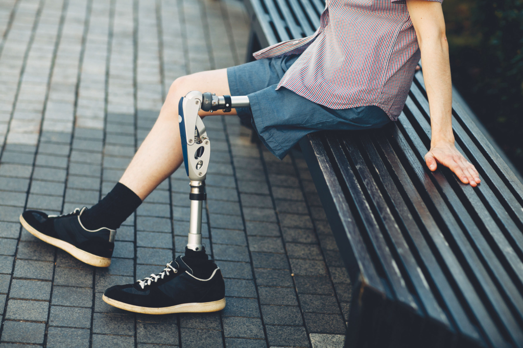 A person with a leg amputation sits on a bench.